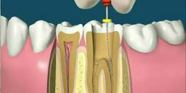 Endodontia