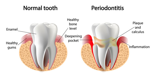 Periodontia