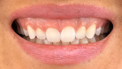 Periodontia1