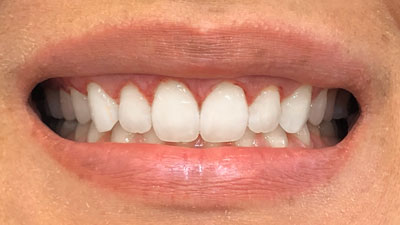 Periodontia2